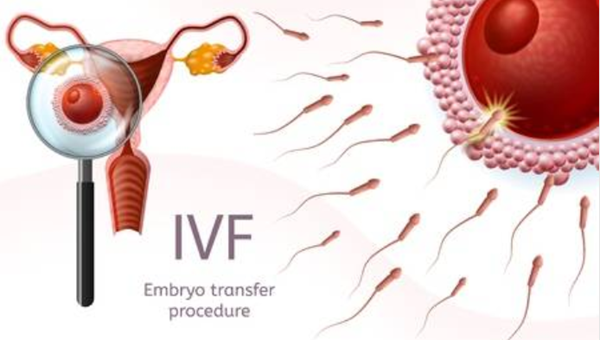 卵巢会影响泰国试管婴儿成功率吗