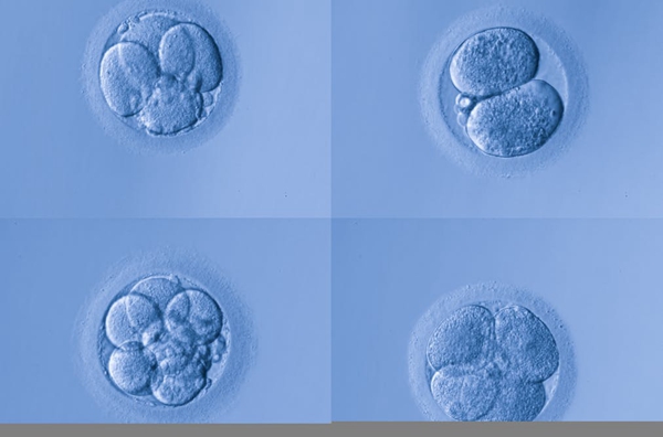 泰国试管婴儿过程中 冻胚移植（FET）成功率高于鲜胚
