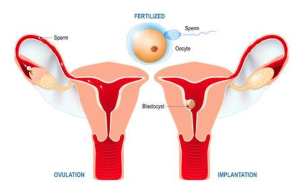 泰国试管婴儿：卵巢异常对女性有哪些影响
