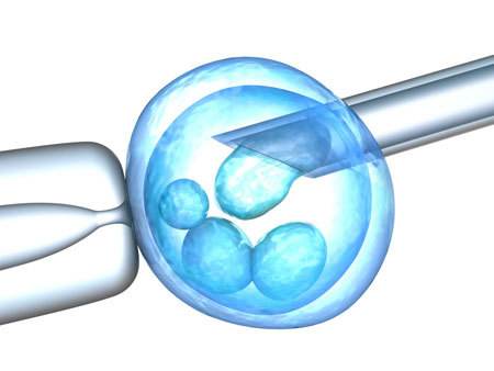 卵浆内单精子注射(ICSI)是如何实现精卵结合的？