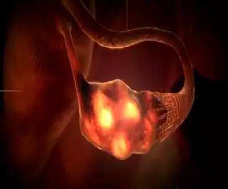 应该怎么选择泰国试管婴儿的促排卵方案?
